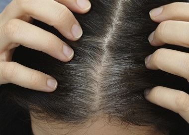 Peut-on prévenir l'apparition des cheveux gris ?