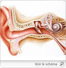 acouphenes_pm