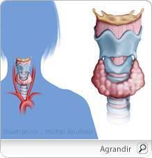 hyperthyroidie_pm